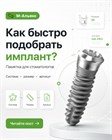 Как заказать имплант: система, размер и артикул